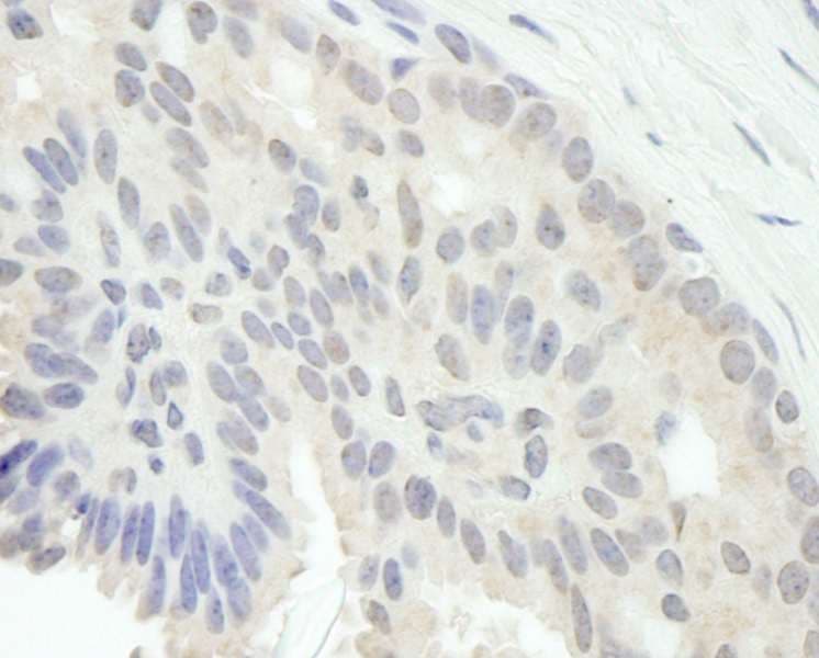 E2F1 Antibody (aa300-350)