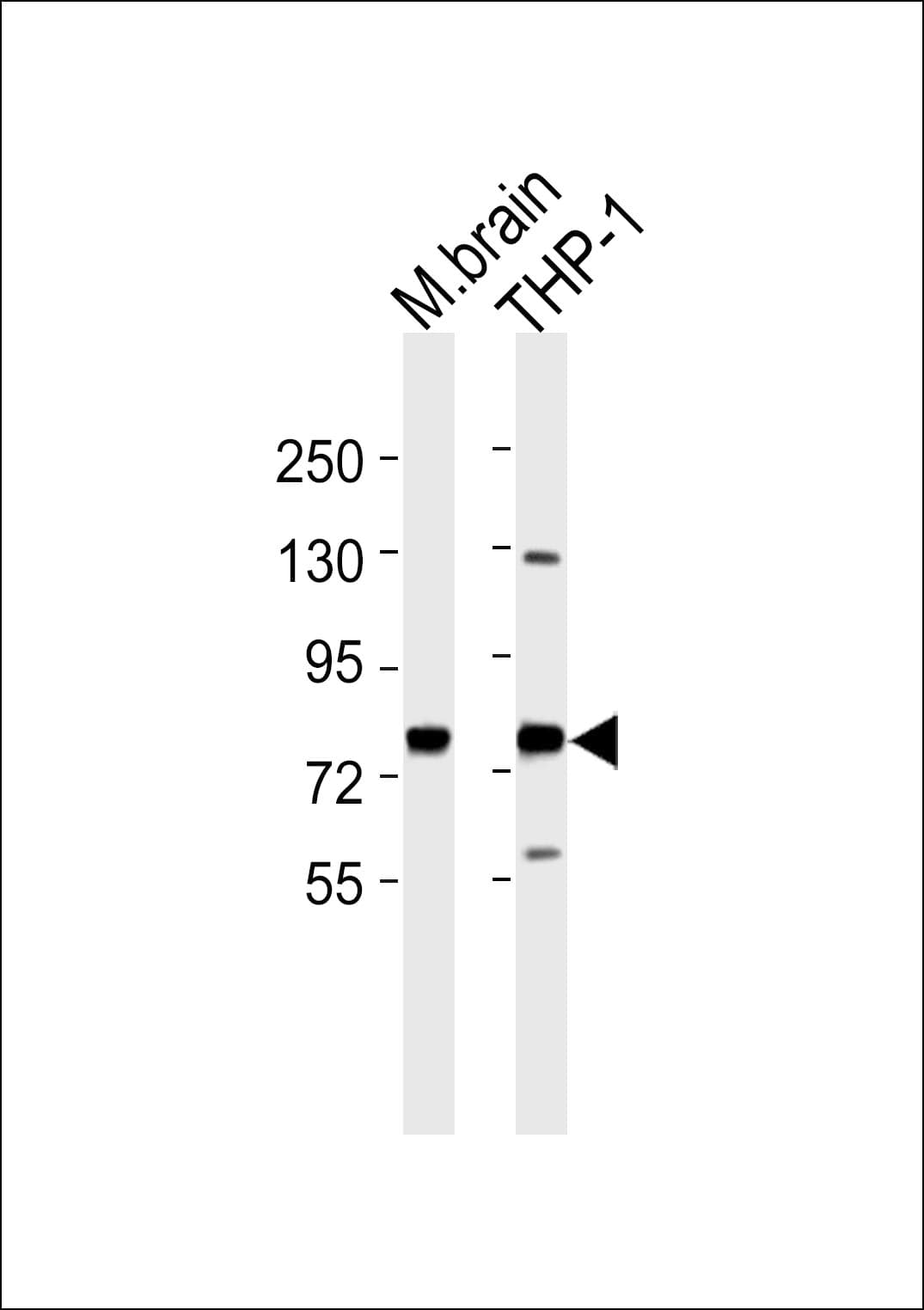 GUCY1A1 / GUCY1A3 Antibody