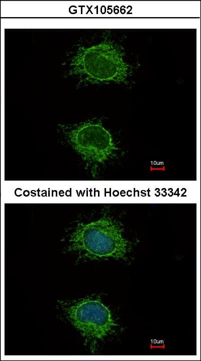 NDUFS4 Antibody (aa1-175)