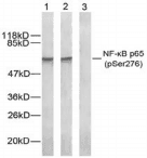 RELA / NFKB p65 Antibody