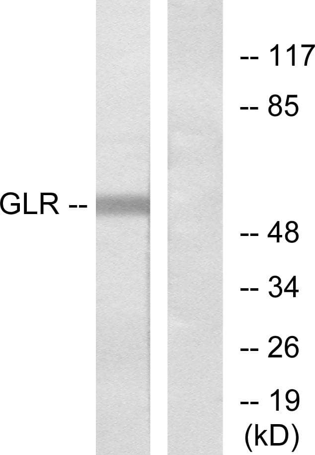 GCGR / Glucagon Receptor Antibody