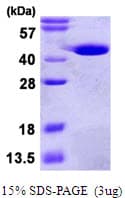 Human GMPR1 / GMPR Protein (Recombinant His)