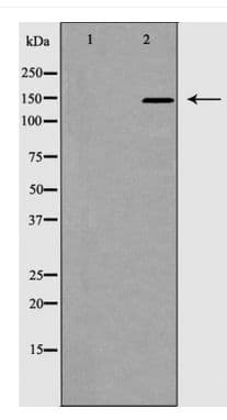 ACE / CD143 Antibody