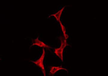Polyclonal Rabbit anti-Human CD71 / Transferrin Receptor Antibody (IHC, IF, WB)