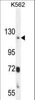 ATP8A2 Antibody (aa293-322)