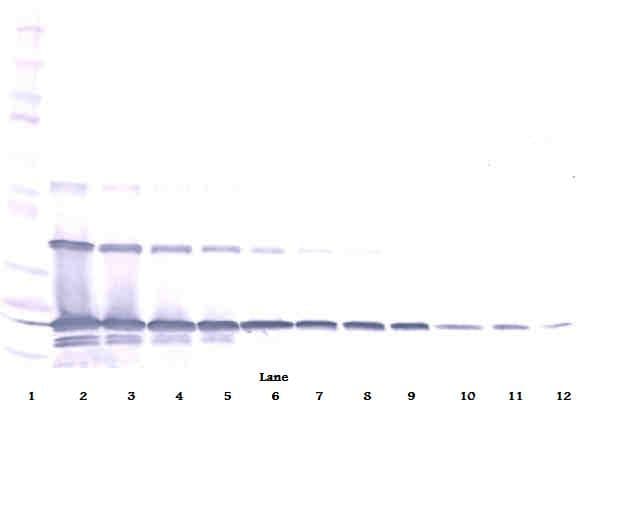 IHC-plus™ Polyclonal Rabbit anti-Human TNFSF11 / RANKL / TRANCE Antibody (IHC, WB)