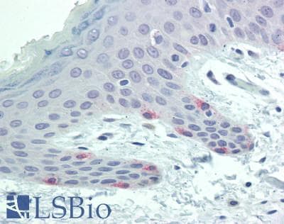 PathPlus™ Tyrosinase Antibody