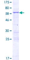 Human FSD1L Protein (Recombinant GST)