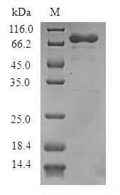Human ADAP1 / CENTA1 Protein (Recombinant GST, N-terminus)