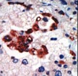 PRKCI / PKC Iota Antibody (aa176-207)
