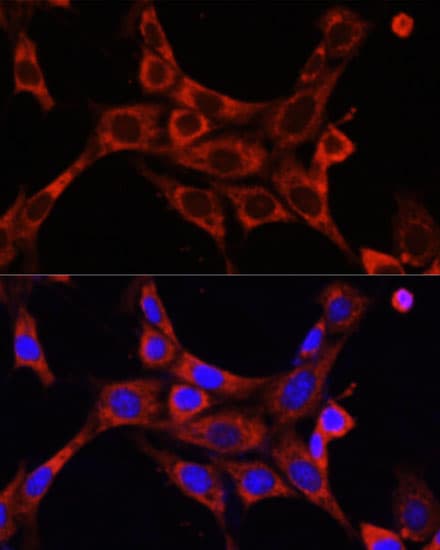 IRAK1 / IRAK Antibody
