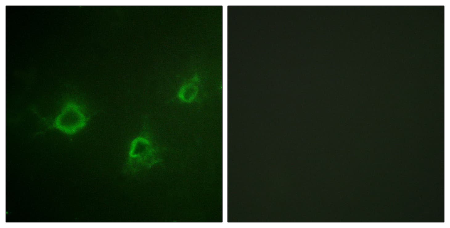 Polyclonal Rabbit anti-Human PLCG1 Antibody (aa1221-1270, IF)