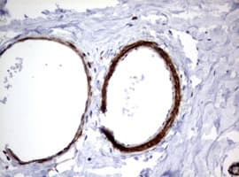 Hamartin / TSC1 Antibody (clone OTI3A2)