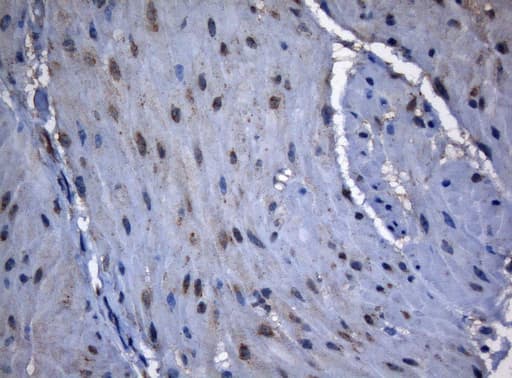 ZNF217 Antibody (aa730-1048, clone OTI3G5, Carrier-free)