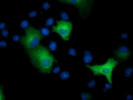 EPHX2 / Epoxide Hydrolase 2 Antibody (clone OTI2F2, Carrier-free)