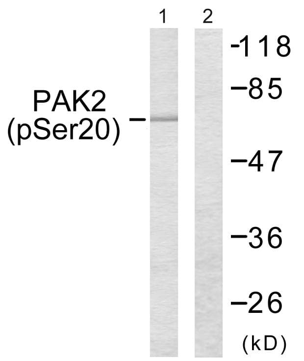 PAK2 Antibody (phospho-Ser20)