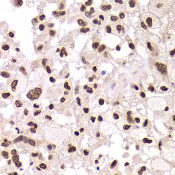 XRCC6 / Ku70 Antibody