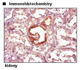 Polyclonal Rabbit anti-Human SLC1A4 / ASCT1 Antibody (IHC, WB)