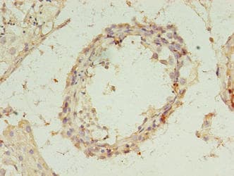 REXO4 / MPMC2 Antibody