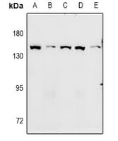 Polyclonal Rabbit anti-Human ADGRA2 / GPR124 Antibody (IF, WB)