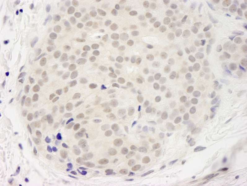 Polyclonal Rabbit anti-Human DDX23 / PRP28 Antibody (aa1-50, IHC)