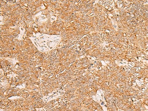 PDCD4 Antibody
