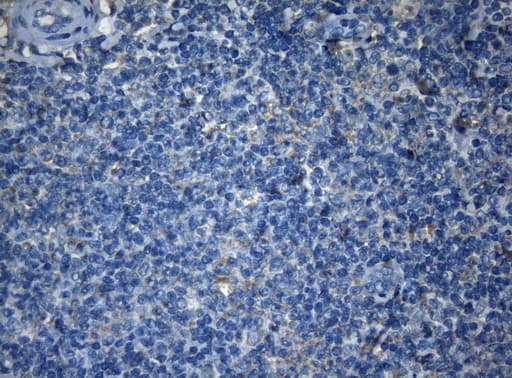 AKT1 Antibody (clone OTI1D12, Carrier-free)