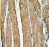 PGAM2 Antibody (aa12-41)