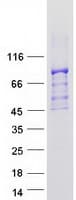 Human GLNRS / QARS Protein (Recombinant Myc-DDK (Flag))
