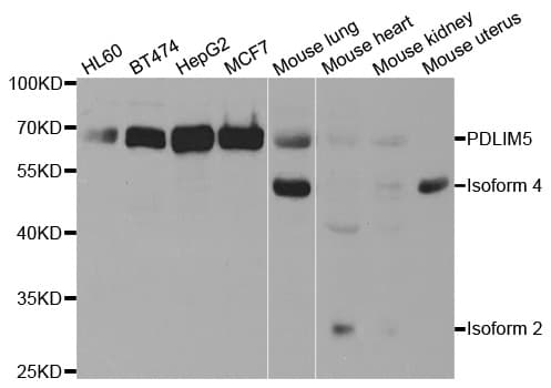 Polyclonal Rabbit anti-Human PDLIM5 / LIM Antibody (IHC, IF, WB)