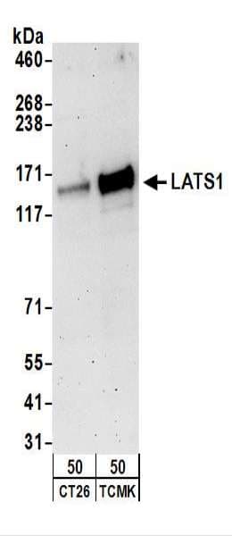 LATS1 Antibody (aa50-100)