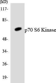 IHC-plus™ Polyclonal Rabbit anti-Human RPS6KB1 / P70S6K / S6K Antibody (aa372-421, IHC, WB)