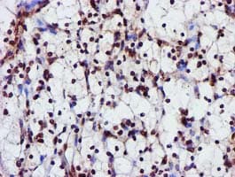 GSTT2 Antibody (clone OTI3B6)