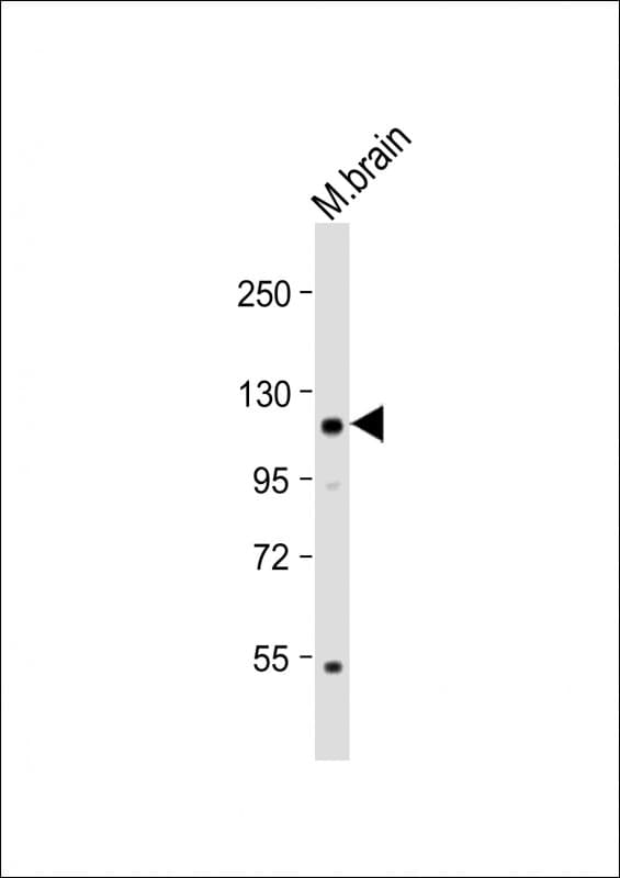 KL / Klotho Antibody