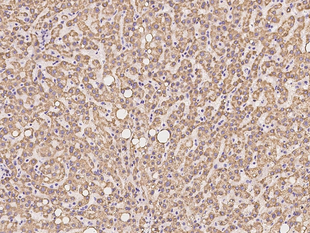 ETFBKMT Antibody