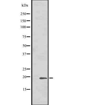 HSPB7 / CvHSP Antibody