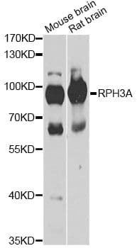 Polyclonal Rabbit anti-Human RPH3A / Rabphilin 3A Antibody (IHC, WB)