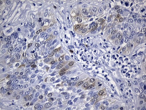 TS / Thymidylate Synthase Antibody (clone UMAB227, Carrier-free)