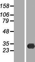 TREX2 Protein (Over-Expression Lysate Myc-DDK (Flag))