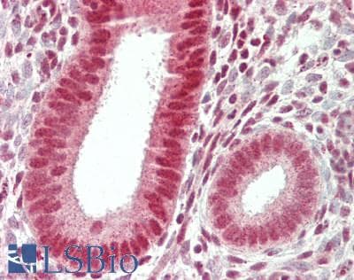 IHC-plus™ CPSF6 Antibody (aa1-50)