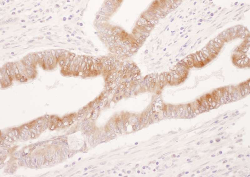 PTGS2 / COX2 / COX-2 Antibody (aa554-604)