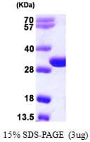 Human TREX2 Protein (Recombinant His)