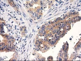 RTN4IP1 / NIMP Antibody (clone OTI3B2)
