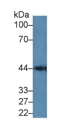 LGALS9C Antibody (aa228-356)