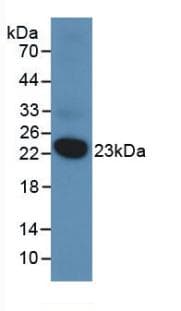 DUSP3 / VHR Antibody (aa2-185)