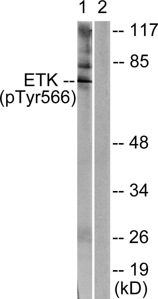 ETK / BMX Antibody (phospho-Tyr566)