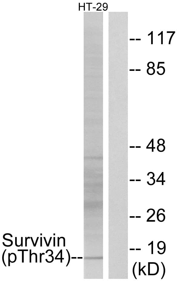 BIRC5 / Survivin Antibody (phospho-Thr34)