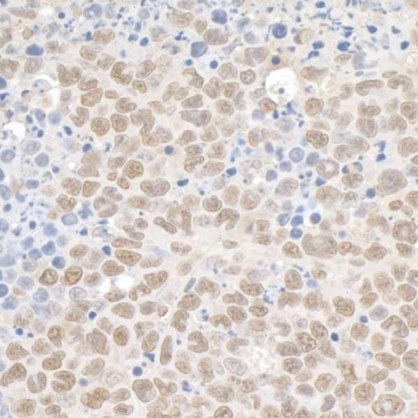 Polyclonal Rabbit anti-Human TRIM28 / KAP1 Antibody (aa650-700, IHC, WB)