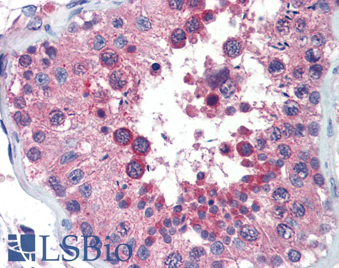 ZNF165 Antibody (aa216-265)