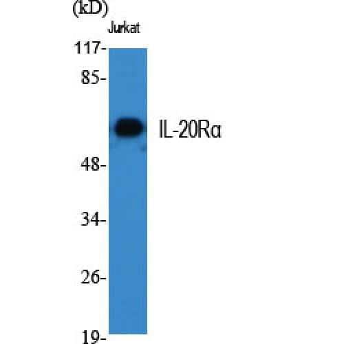 IL20RA Antibody (Internal)